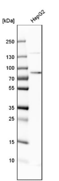 Transferrin Antibody, Novus Biologicals 0.1mL; Unlabeled:Antibodies, Polyclonal